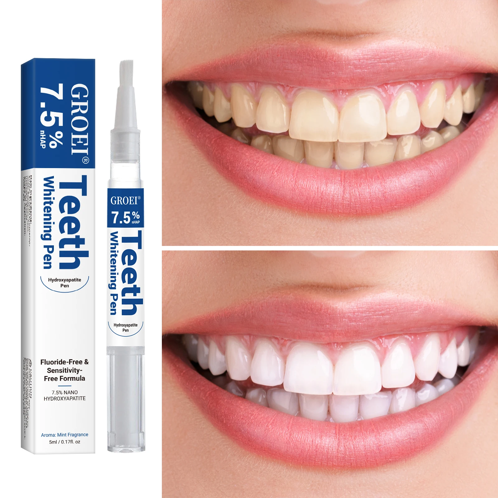 Hydroxyapatite Tooth Whitening - огляд і ціна Teeth Whitening With Hydrogen Peroxide