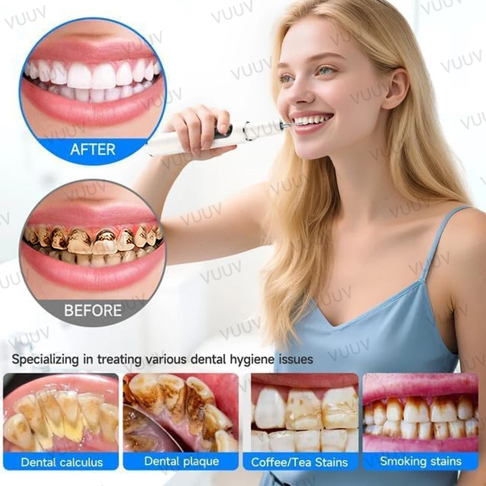 VUUV Ultrasonic Teeth Cleaner  - огляд і ціна Teeth Whitening Uv