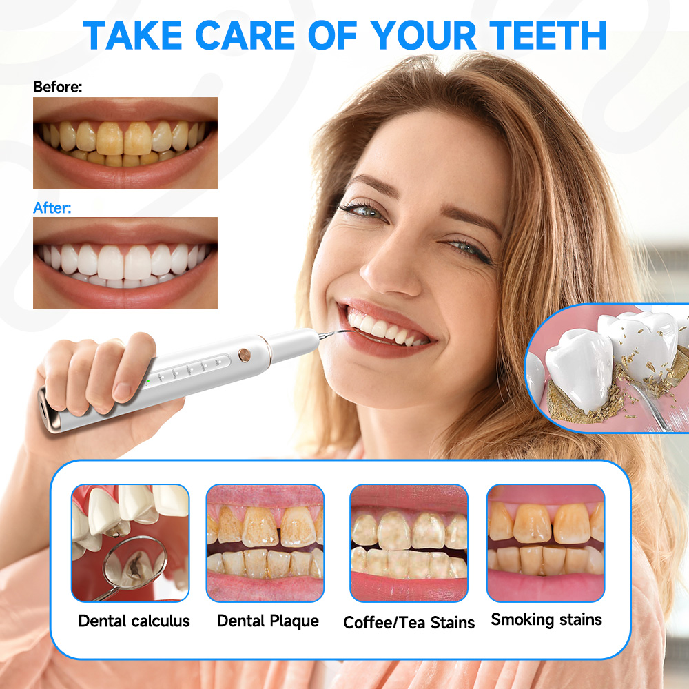 CURVY MOON T4 Portable Ultraso - огляд і ціна Teeth Whitening Uv