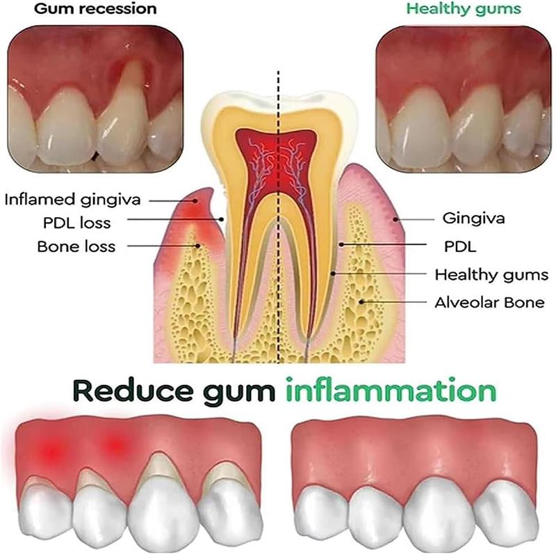 Teeth Whitening Gel Gum Repair - огляд і ціна Teeth Whitening Gels