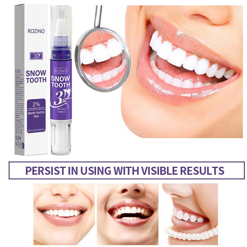 Portable Teeth Whitening Pen R - огляд і ціна Whitening Pen Bleach