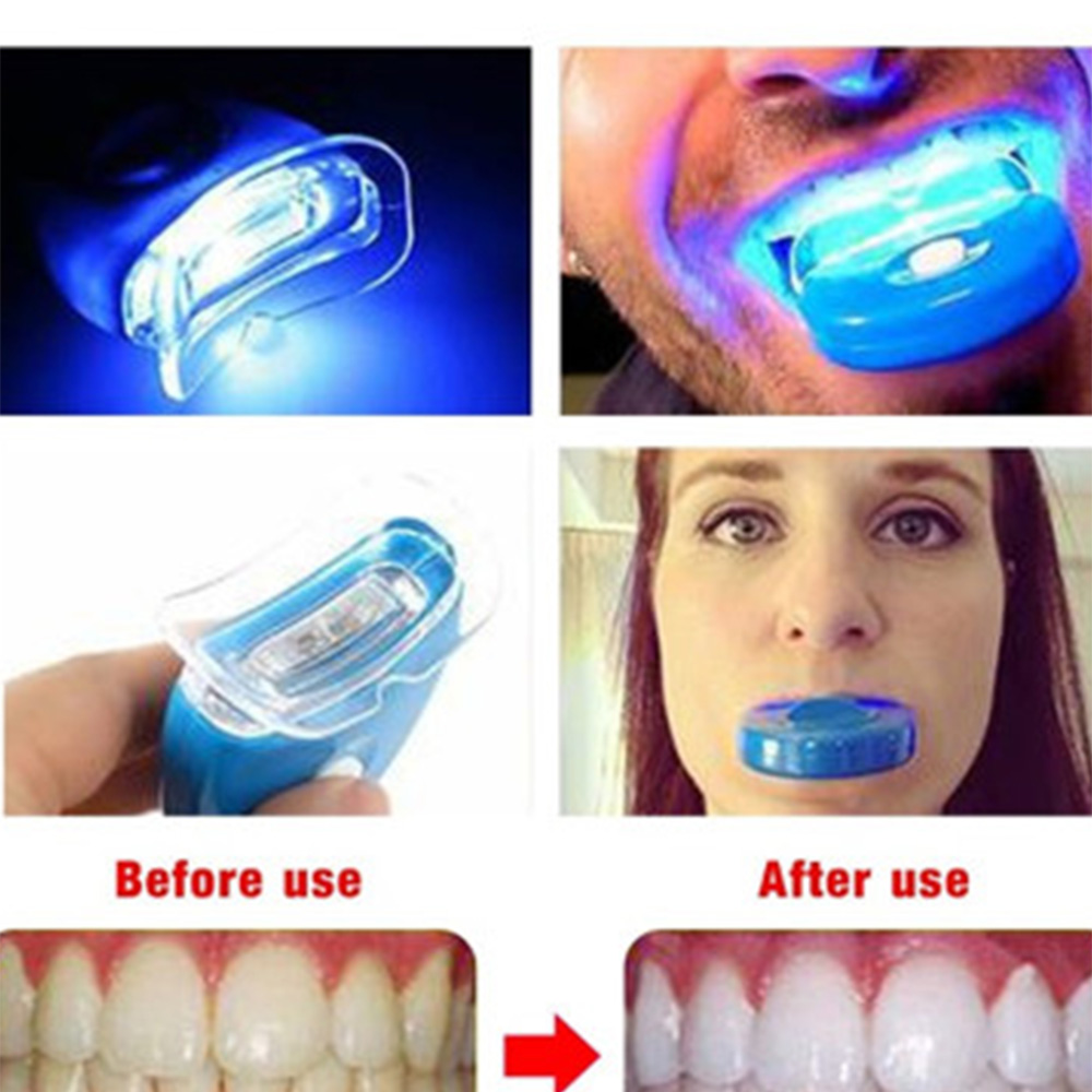 New Blue Led Teeth Whitening A - огляд і ціна Teeth Whitening Uv