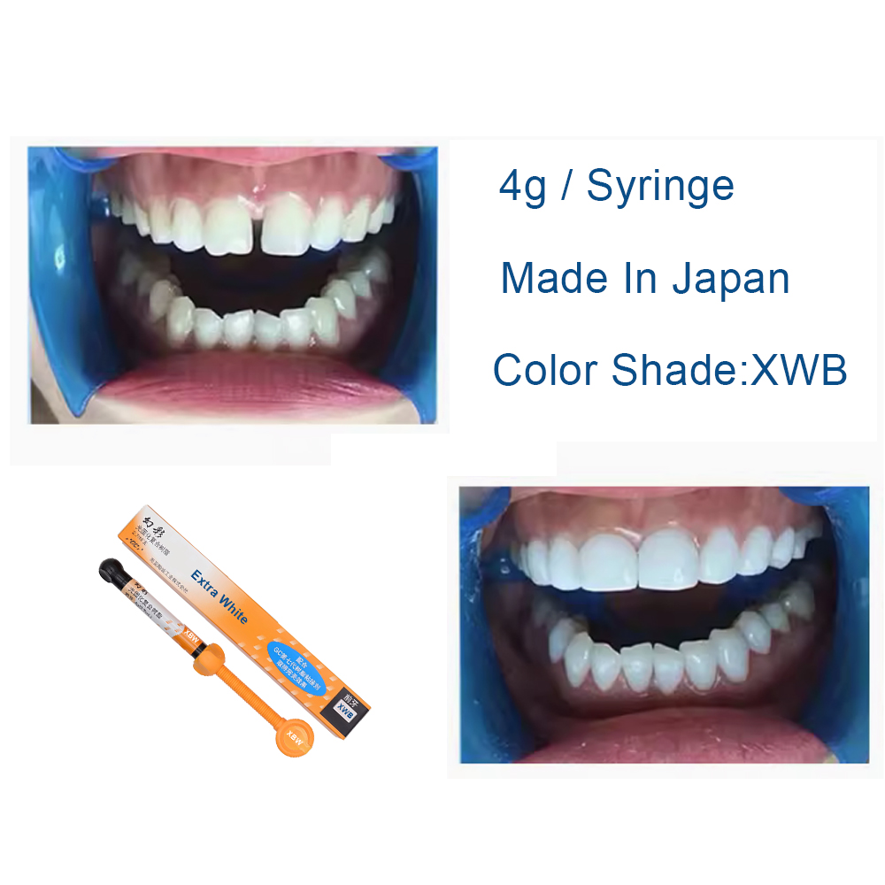 Dental Composite Resin Extra W - огляд і ціна Teeth Whitening Professional