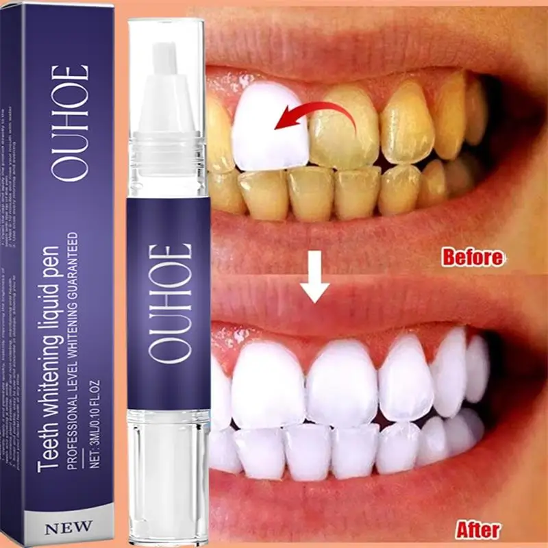Fast Teeth Whtening Toothpaste - огляд і ціна Whitening Pen Bleach