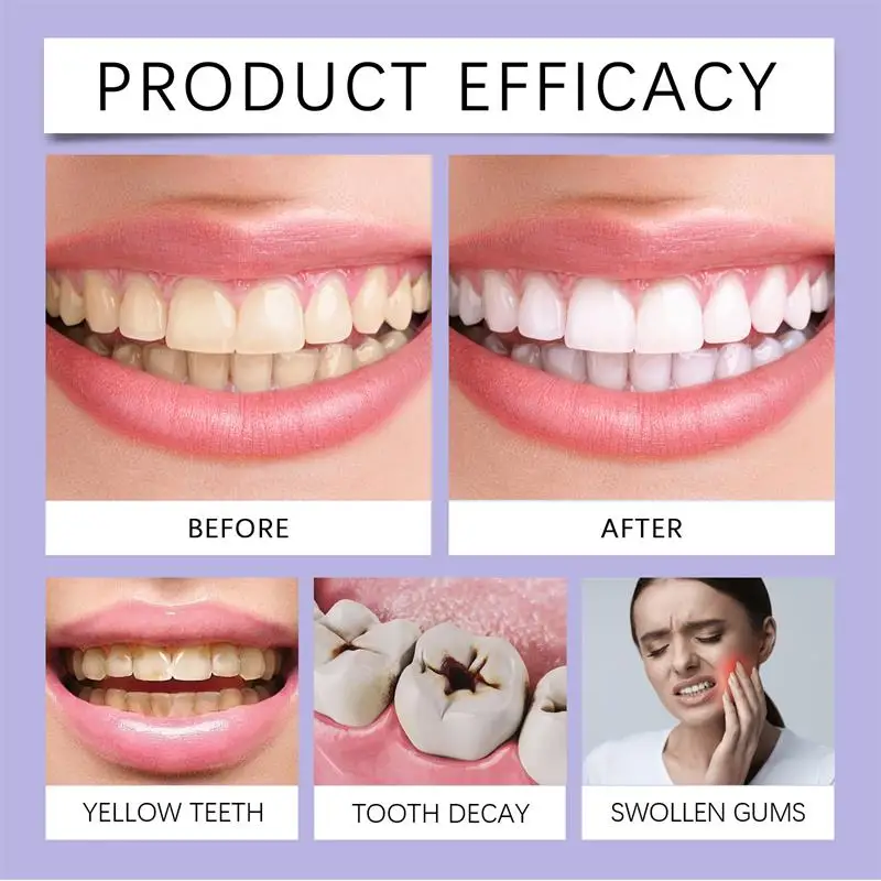 Fast Teeth Whtening Toothpaste - огляд і ціна Whitening Pen Bleach